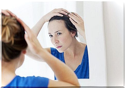 woman with dandruff