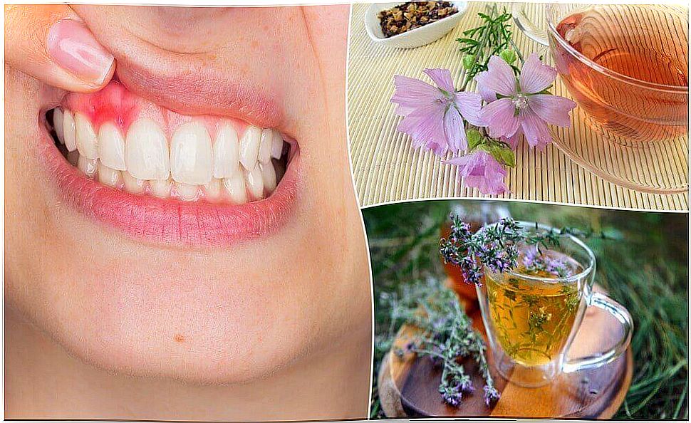 Five natural treatments for gingivitis