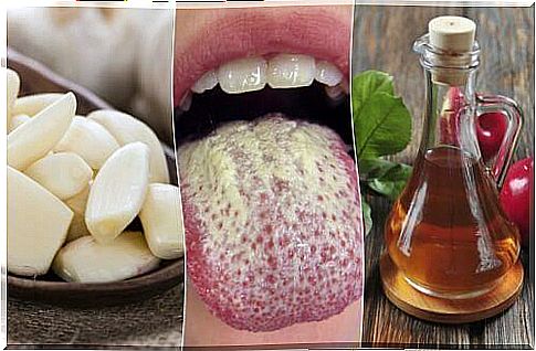 How to curb yeast growth 6 with natural remedies