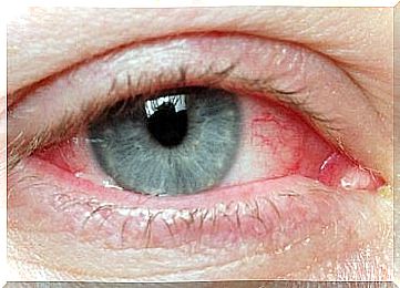 eye infection