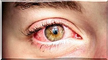 reddening eye